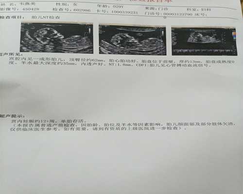 黑龙江代怀价格费用,黑龙江省医院试管婴儿怎么样，2023
助孕试管费用估算