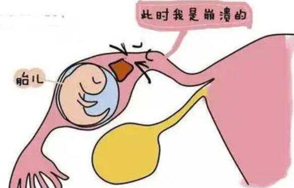 哈尔滨高薪招捐卵 哈尔滨正规试管医院汇总 ‘怀孕37周怀女孩有什么症状’