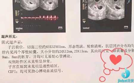 广州代孕网成功率,泰国试管二次移植需要多少钱-试管婴儿打黄体酮的副作用